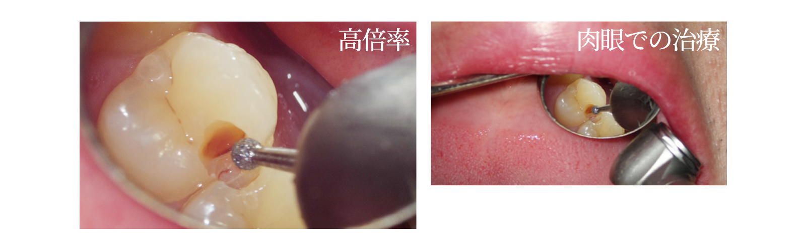 マイクロスコープ