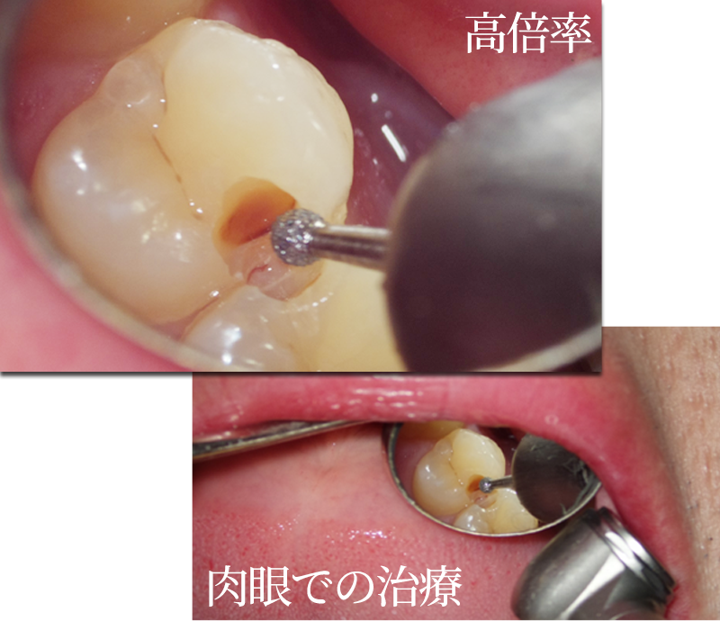 マイクロスコープ