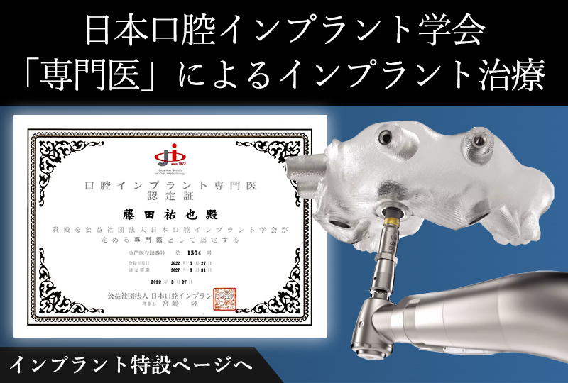大津市 インプラント